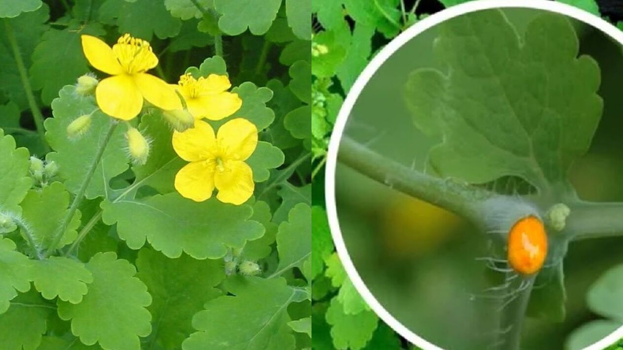 zelandina garatxoen aurka